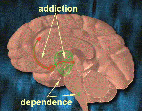 A side view of a brain showing with addiction and dependence labels